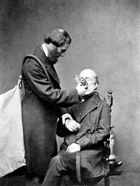 Joseph Clover administering chroloform from his inhaler.