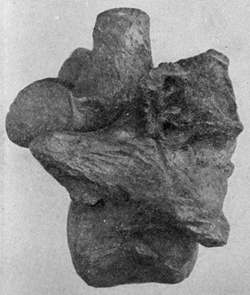 Diseased vertebra of Smilodon from the Pleistocene deposits of California