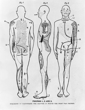 Diagram showing method of packing for mummification.