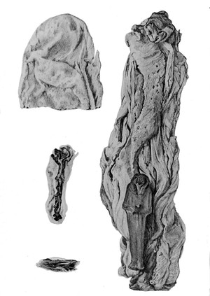 view Drawings of roll of intestines.