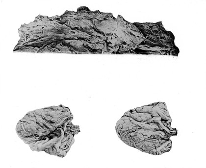 Drawings of lung and heart.