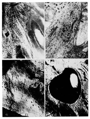 view Photomicrographs, histology of dinosaur tumour
