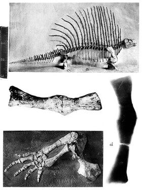 Fracture and callus from Moodie's Paleopathology