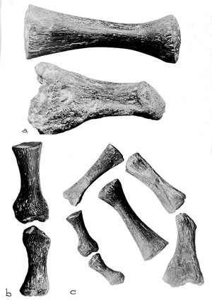 view Multiple arthritis