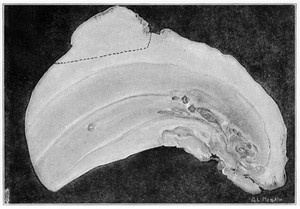 view Median Sagittal section of whales tooth