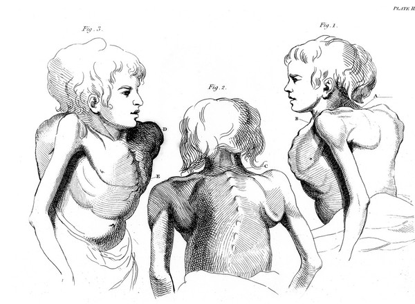 Practical observations on the use of oxygen, or vital air, in the cure of diseases. To which are added a few experiments on the vegetation of plants. Part I / By D. Hill.