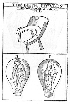 The birth figures, I & II: the womans stooles.