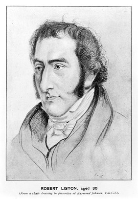 Portrait of Robert Liston, aged about 30 years.