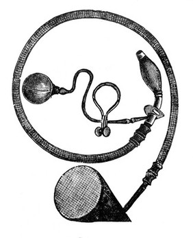 Trendelenberg's tracheal tampon canula chloroform apparatus.