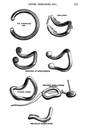 Obstetrics, Lever pessaries of various types