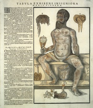 view Anatomical fugitive sheet, male