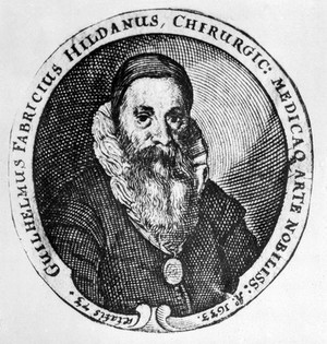 view Portrait of Gulielmus Fabricius Hildanus (1560-1634). Bust in oval