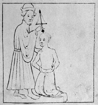 13th century trepanation.