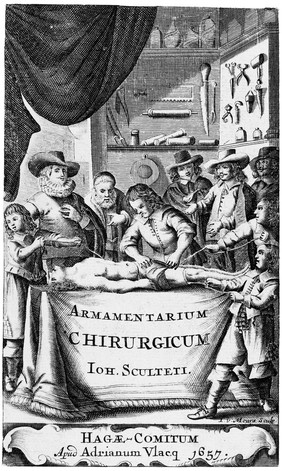 A surgical operation, by Johannes van Meurs, circa 1657