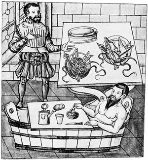 view C. Stromayr: Pre-operation scene. 1559