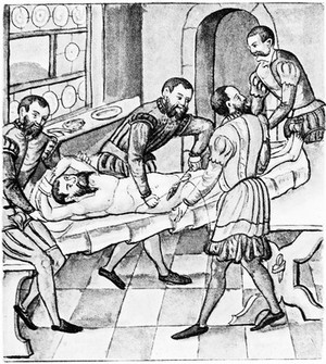 view C. Stromayr: Sewing wound after herniotomy. 1559