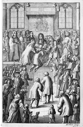 Adenochoiradelogia, or, An anatomick-chirurgical treatise of glandules & strumaes, or Kings-Evil-swellings : Together with the royal gift of healing, or cure thereof by contact or imposition of hands, performed for above 640 years by our Kings of England, continued with their admirable effects, and miraculous events; and concluded with many wonderful examples of cures by their sacred touch / All which are succinctly described by John Browne.