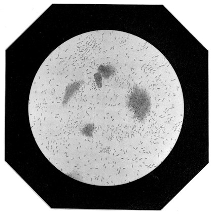 M0010710: Yeast in a string-of-beads formation, evidence of illness "morts-flats" in the stomach pouch of a silk worm chrysalis