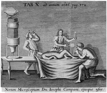 Illustration to show the use of the microscope in medicine, (Campani's microscopes).