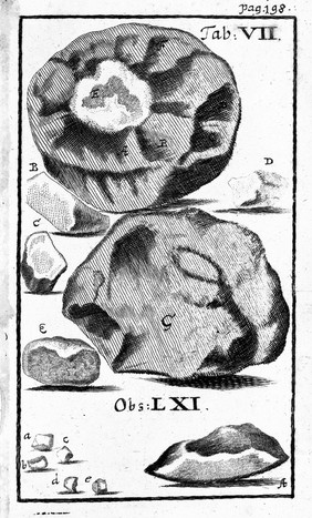 Thesaurus medico-chirurgicarum observationum curiosarum. Das ist: Medicin-chirurgischer Schatz sonderbarer Anmerckungen, welche sowohl in Praxi medica, anatomica, als vornehmlich in Chirurgia vorgefallen, mit allen Umständen, Ursachen und Curen, erleutert ... / [Conrad Ludwig Walther].