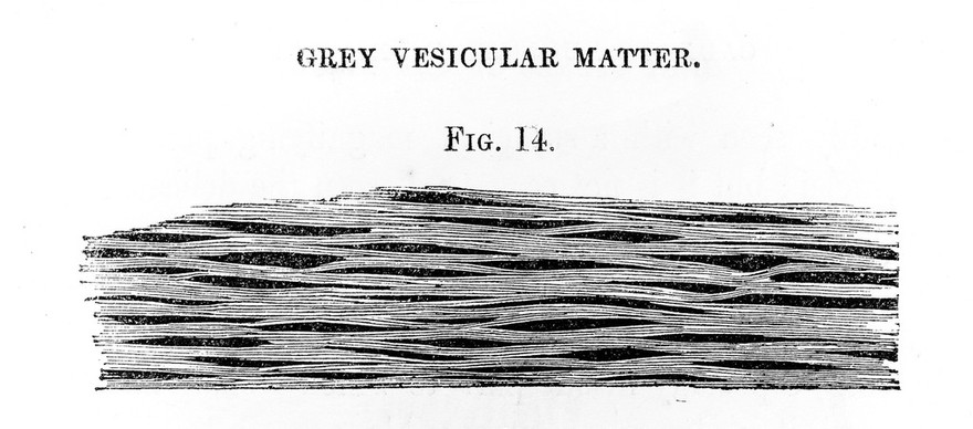 Grey vesicular matter. Anastomosing grey fibres of human retina.