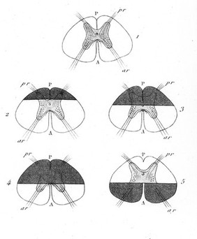 Brown-Sequard, sections of spinal cord of guinea pig