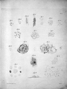 M0011428: Microscopal examination of various types of tumour