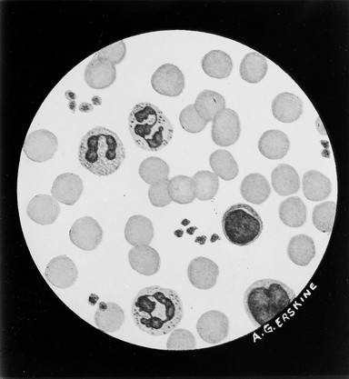 Normal blood picture; Giemsa stain.