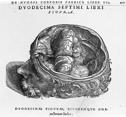 Andreae Vesalii Bruxellensis, scholae medicorum Patauinae professoris De humani corporis fabrica libri septem.