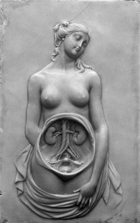 Wax plaque showing the embryo: foetus in uterus