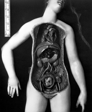 view French female figure modelled in wax, parts removed to show the foetus and the structures beneath the stomach