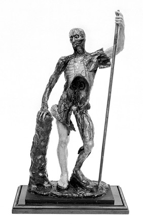 Anatomical figure in wax.