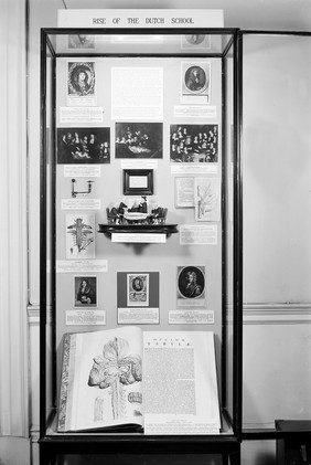 Exhibition: British medicine and the Continent, 1600-1850