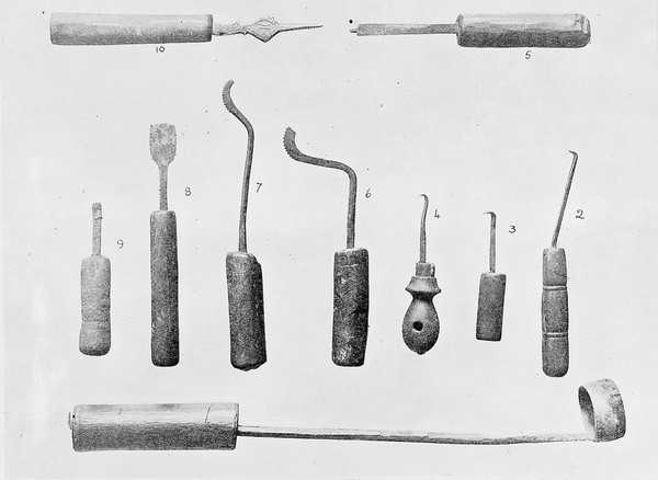 Trepanning instruments used by the Arabs of Algeria