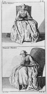 L'orthopédie, ou, l'art de prevenir et de corriger dans les enfans, les difformités du corps / [Nicolas Andry de Bois-Regard].