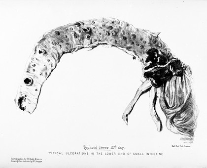 Typhoid fever : its nature, mode of spreading, and prevention / by William Budd.