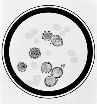 M0013298: Graph showing the effect on blood cells of the removal of the spleen