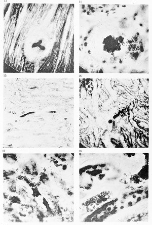 view Various bacilli in Koch, 'Zur untersuchung von pathogen...'