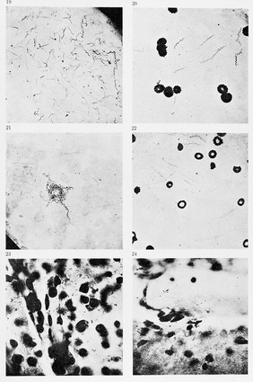 Various bacilli from Koch, 'Zur untersuchung von pathogen...'