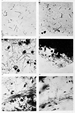 view Bacilli of milignant odema and in cornea of pox in sheep