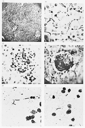 Anthrax bacillus.