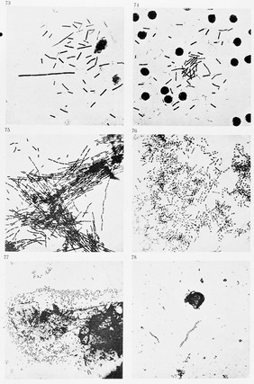 M0013314: Magnifications of various bacilli