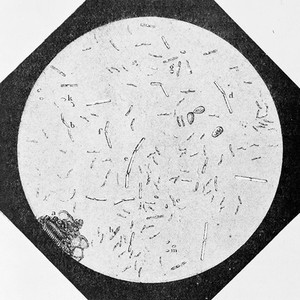 view Silkworm disease called flachery, Pasteur.