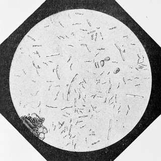 Silkworm disease called flachery, Pasteur.