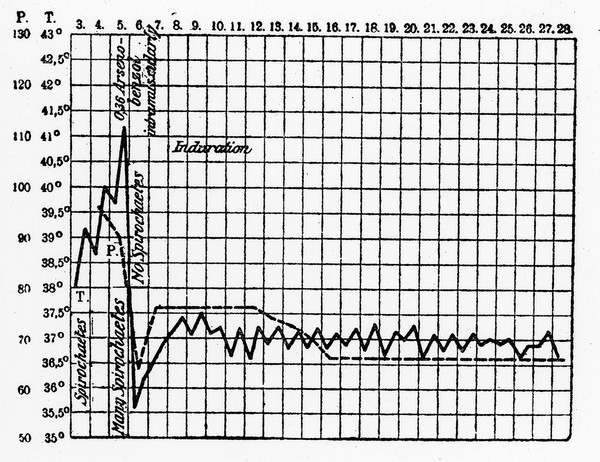 M0013361: Graph showing temperature curve for relapsing fever cases.