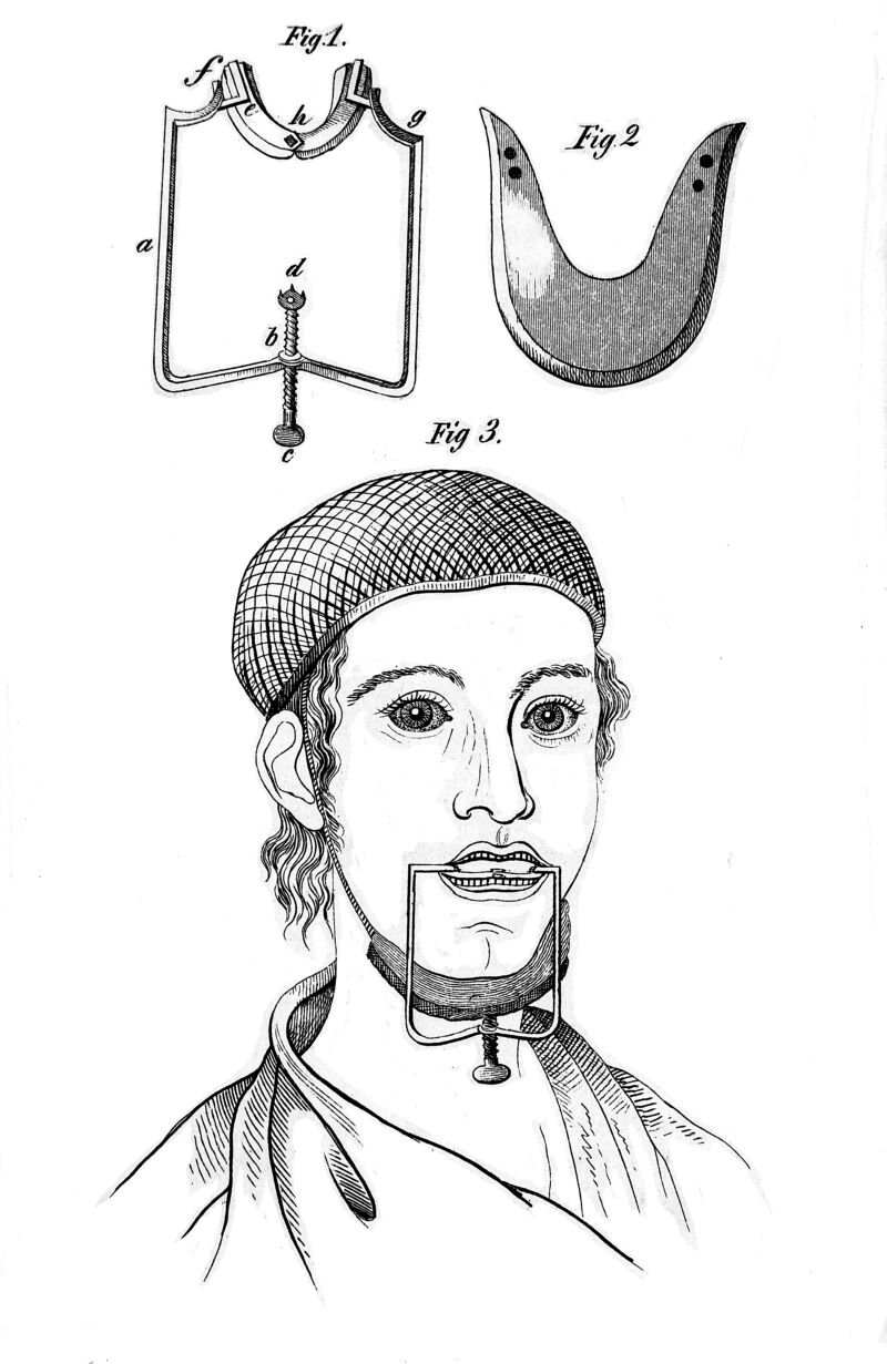 No text description is available for this image