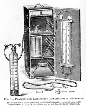 The pneumothorax and surgical treatment of pulmonary tuberculosis / by Clive Riviere.