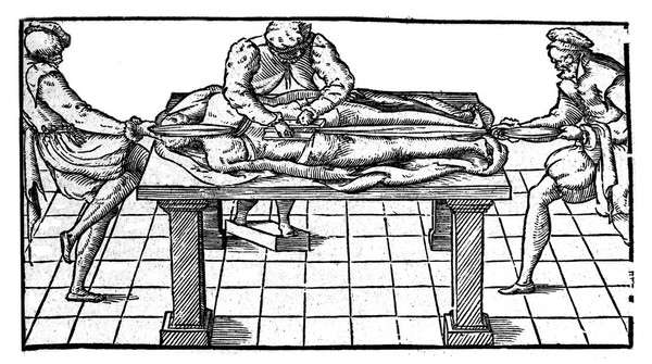 Correction of dislocation of the spine, from Ambrose Pare.