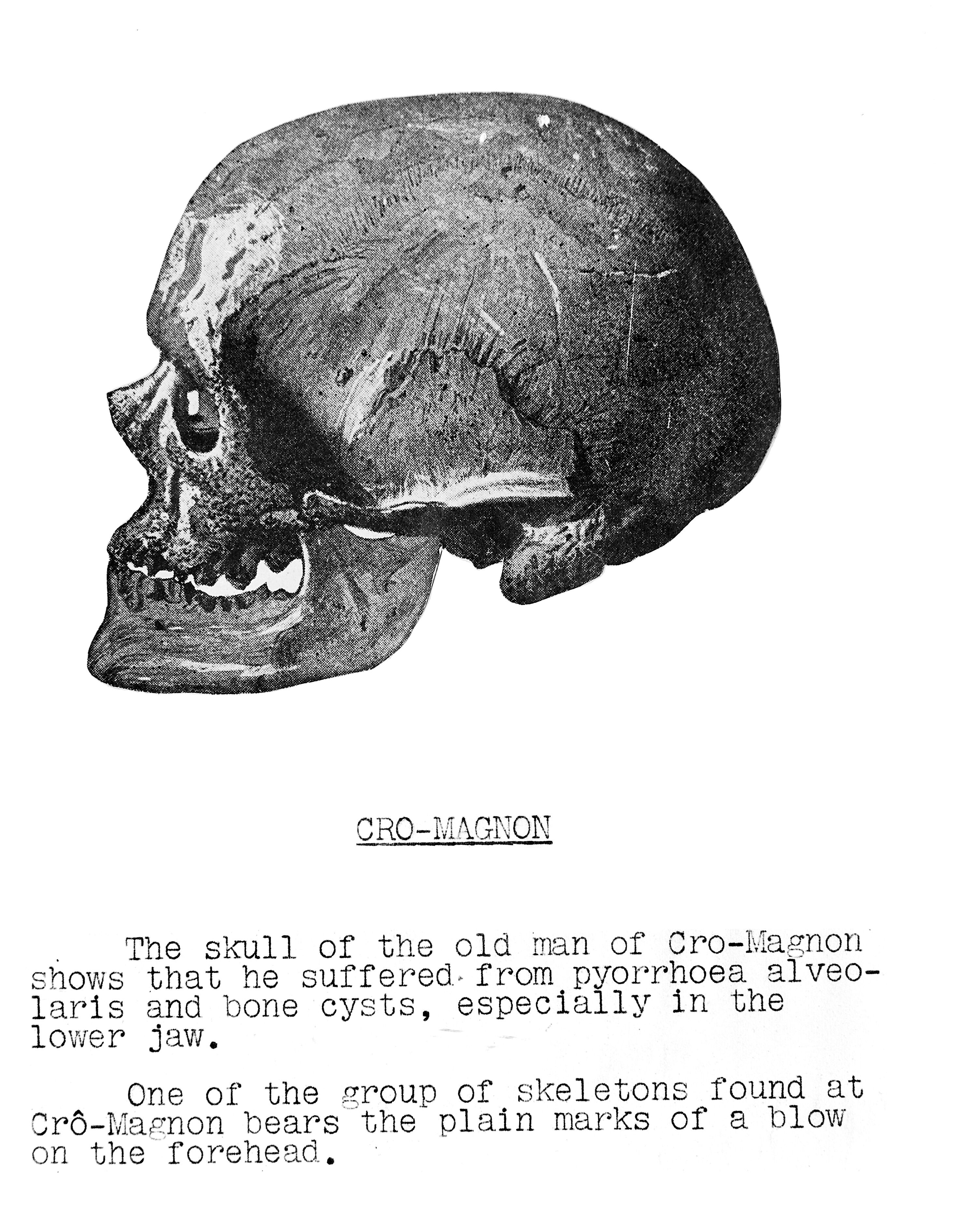 Skull Of The Old Man Of Cro Magnon Wellcome Collection
