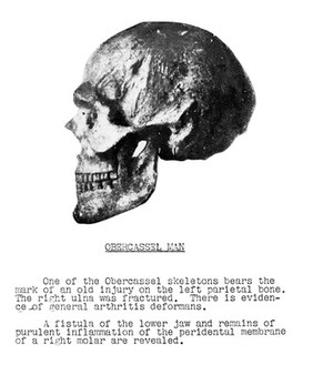 view Skull of the Obercassel Man